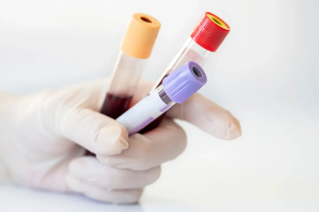 Glove holding test tubes